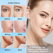 LUXE Face & Neck Lift Device - Wrinkle Removal